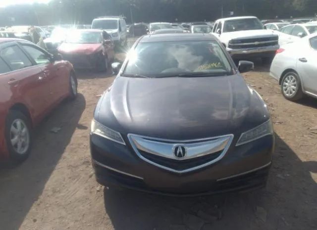 Photo 5 VIN: 19UUB1F37GA008203 - ACURA TLX 