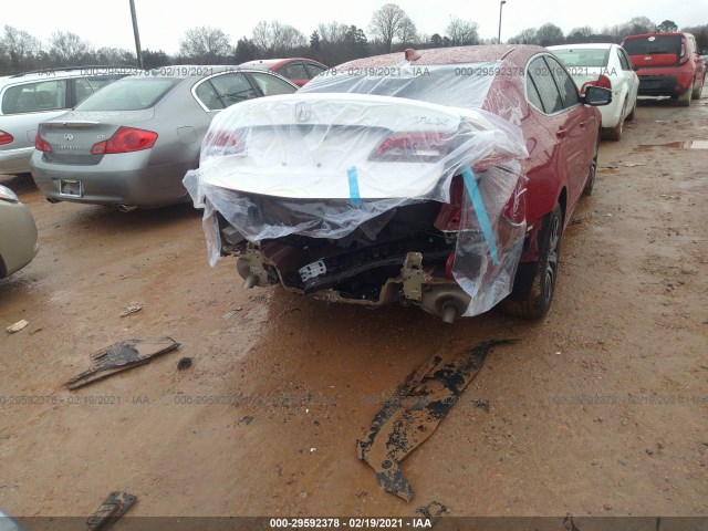 Photo 5 VIN: 19UUB1F38HA000810 - ACURA TLX 