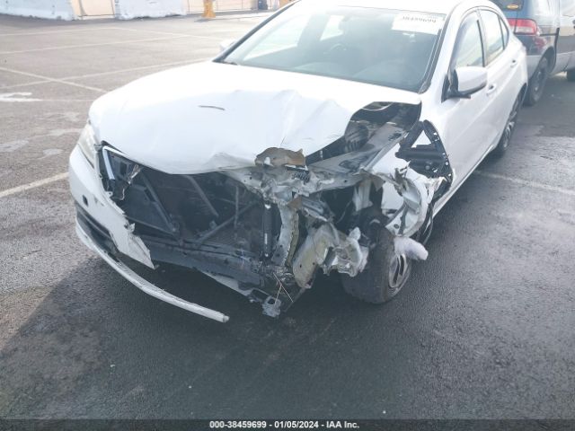 Photo 5 VIN: 19UUB1F38HA009300 - ACURA TLX 