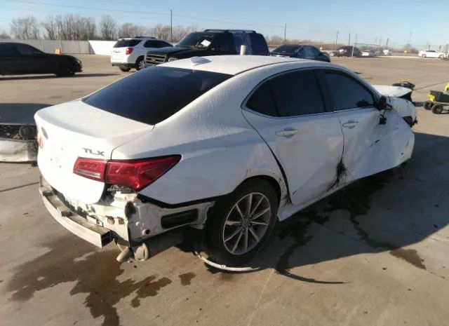 Photo 3 VIN: 19UUB1F38JA007861 - ACURA TLX 