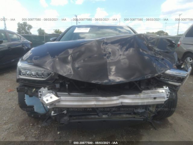 Photo 5 VIN: 19UUB1F38LA009967 - ACURA TLX 