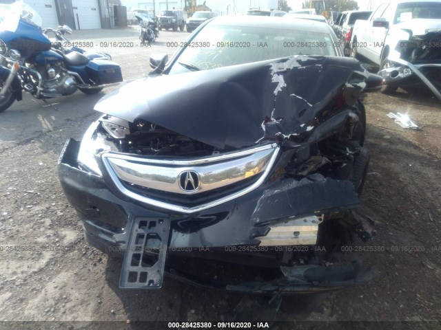 Photo 5 VIN: 19UUB1F39GA003049 - ACURA TLX 