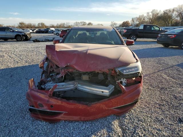 Photo 4 VIN: 19UUB1F39KA003982 - ACURA TLX 