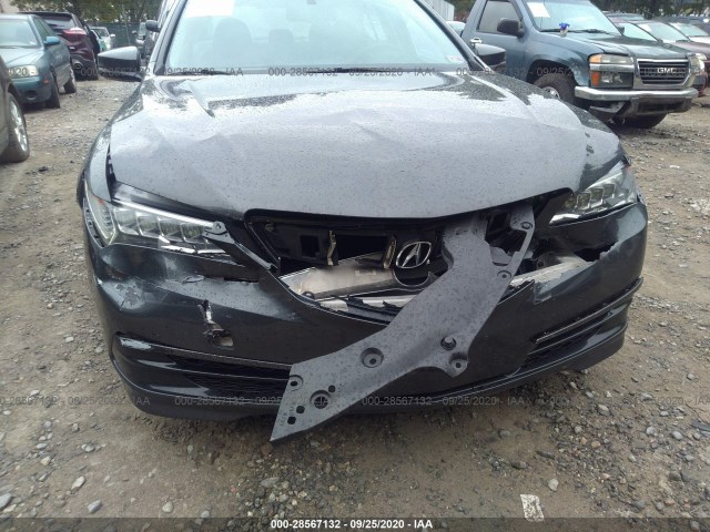 Photo 5 VIN: 19UUB1F3XFA007366 - ACURA TLX 