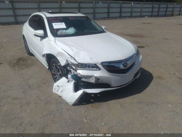 Photo 5 VIN: 19UUB1F50HA001208 - ACURA TLX 