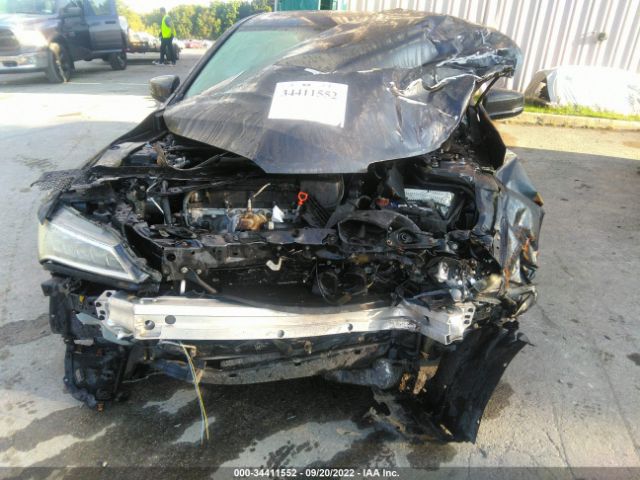 Photo 5 VIN: 19UUB1F51GA013026 - ACURA TLX 