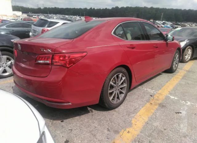 Photo 3 VIN: 19UUB1F51JA007671 - ACURA TLX 