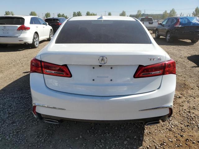 Photo 5 VIN: 19UUB1F52JA800719 - ACURA TLX TECH 