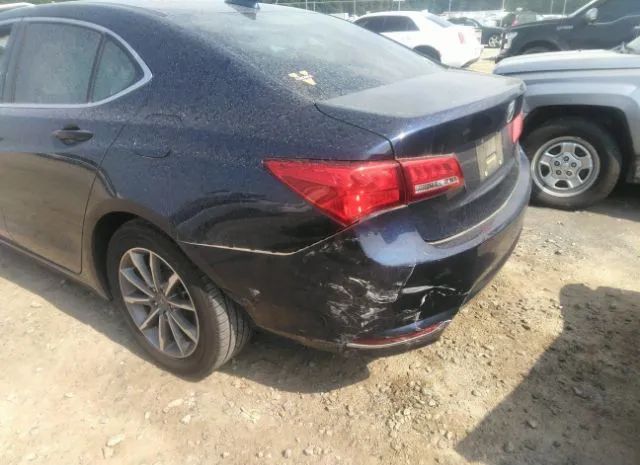 Photo 5 VIN: 19UUB1F53JA006764 - ACURA TLX 