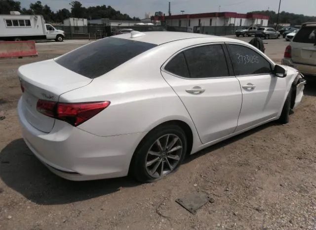 Photo 3 VIN: 19UUB1F53JA007011 - ACURA TLX 