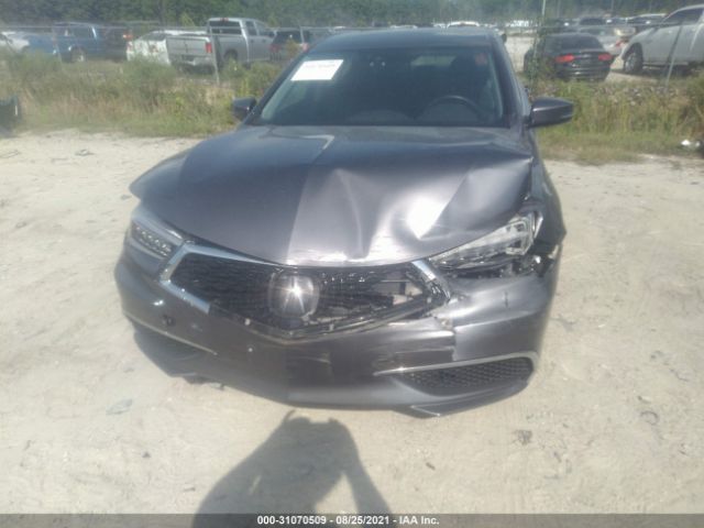 Photo 5 VIN: 19UUB1F53KA010525 - ACURA TLX 