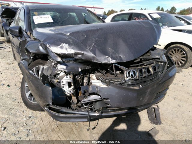 Photo 5 VIN: 19UUB1F54HA001325 - ACURA TLX 