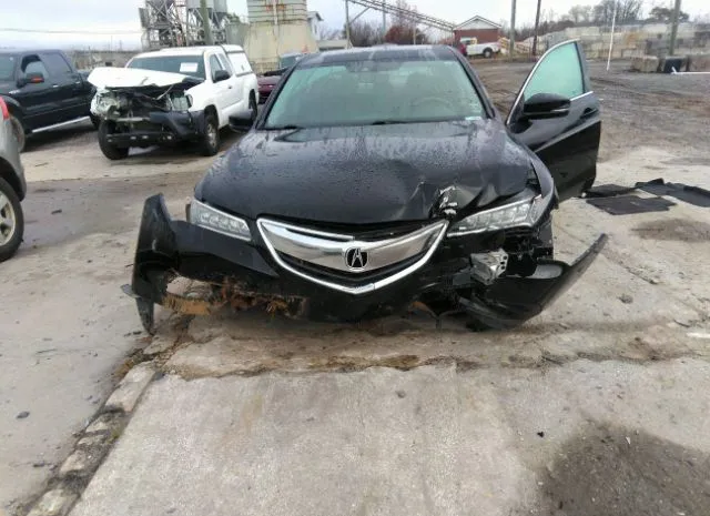 Photo 5 VIN: 19UUB1F55HA003925 - ACURA TLX 