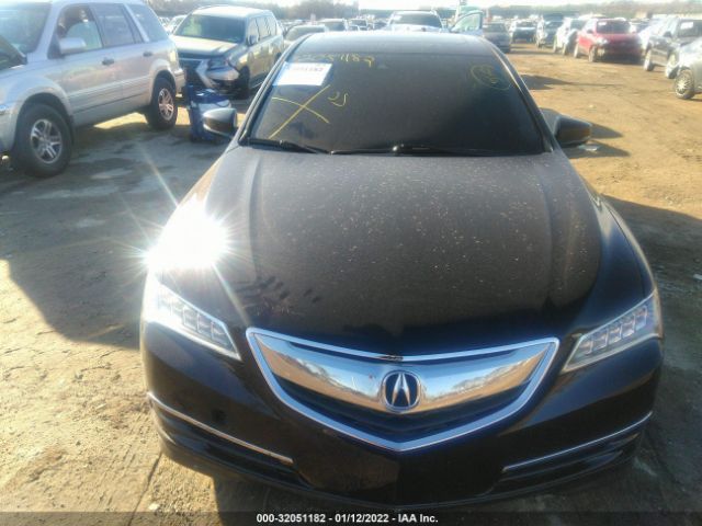 Photo 5 VIN: 19UUB1F55HA004783 - ACURA TLX 