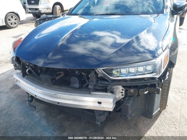 Photo 5 VIN: 19UUB1F55JA005115 - ACURA TLX 