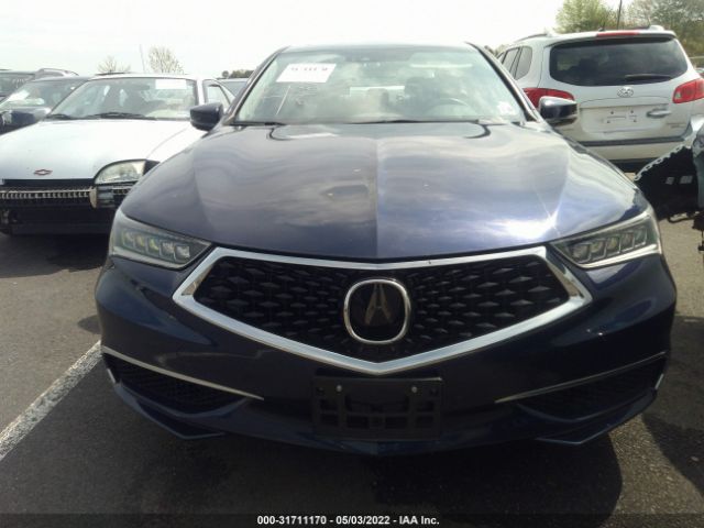 Photo 5 VIN: 19UUB1F55KA001759 - ACURA TLX 