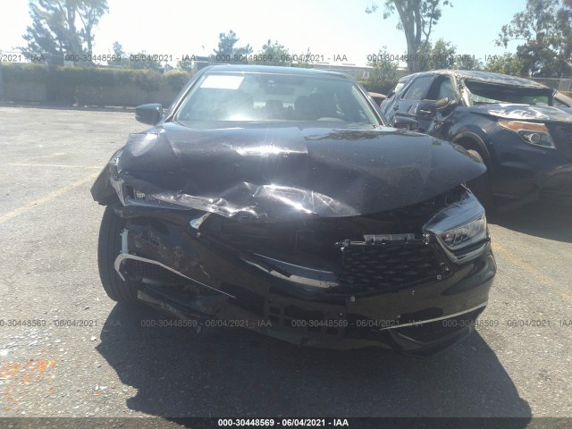 Photo 5 VIN: 19UUB1F55LA011192 - ACURA TLX 