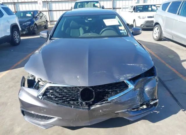 Photo 5 VIN: 19UUB1F55LA013458 - ACURA TLX 