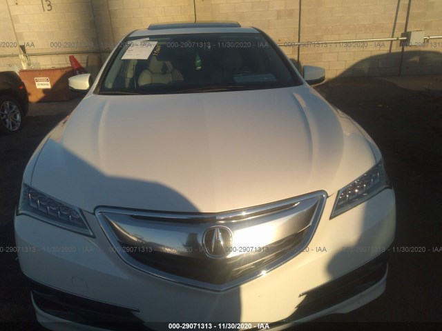 Photo 5 VIN: 19UUB1F56HA001648 - ACURA TLX 