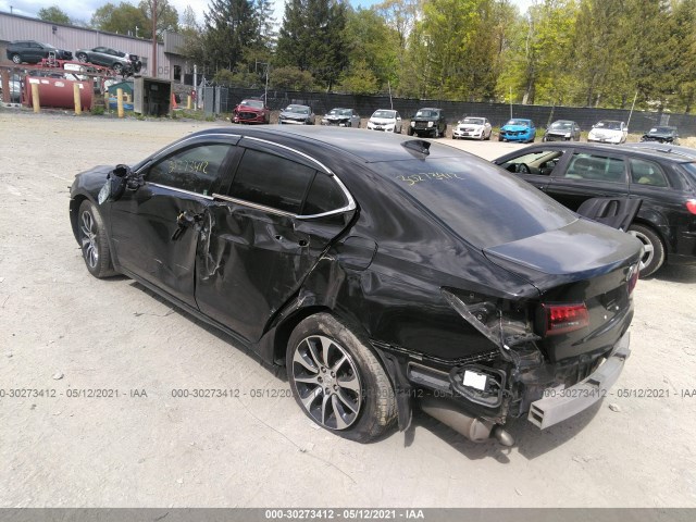 Photo 2 VIN: 19UUB1F57HA000296 - ACURA TLX 