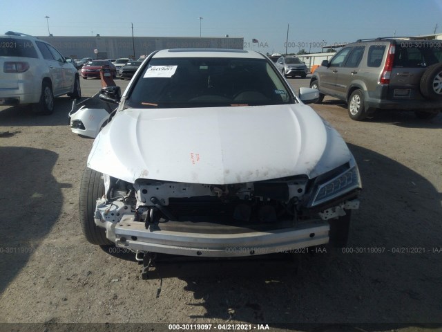 Photo 5 VIN: 19UUB1F57HA002596 - ACURA TLX 