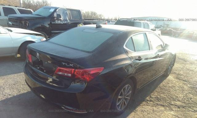 Photo 3 VIN: 19UUB1F57JA003981 - ACURA TLX 