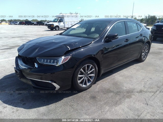 Photo 1 VIN: 19UUB1F57JA005147 - ACURA TLX 