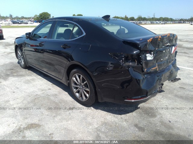 Photo 2 VIN: 19UUB1F57JA005147 - ACURA TLX 