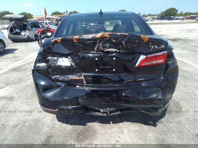 Photo 5 VIN: 19UUB1F57JA005147 - ACURA TLX 