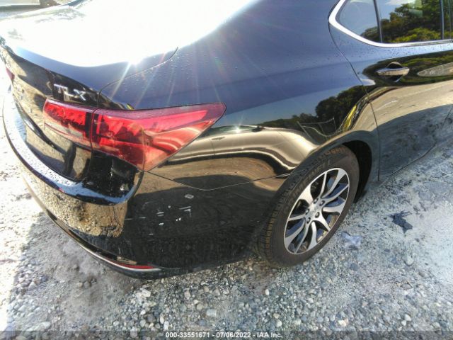 Photo 5 VIN: 19UUB1F58GA004548 - ACURA TLX 