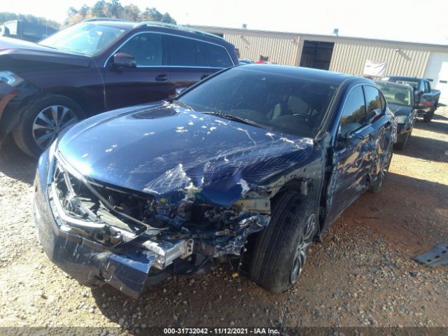 Photo 1 VIN: 19UUB1F58HA006804 - ACURA TLX 