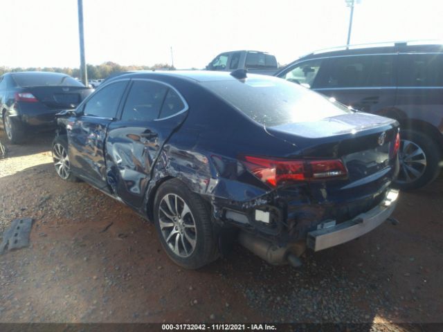 Photo 2 VIN: 19UUB1F58HA006804 - ACURA TLX 