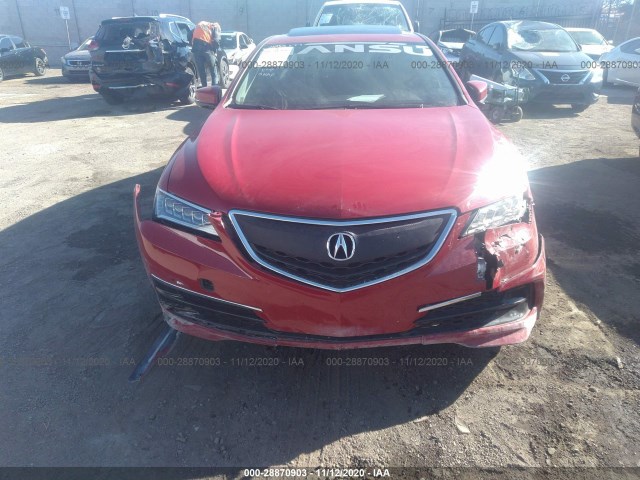 Photo 5 VIN: 19UUB1F58HA007998 - ACURA TLX 