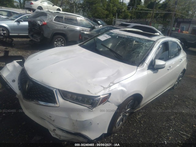 Photo 5 VIN: 19UUB1F58LA009257 - ACURA TLX 