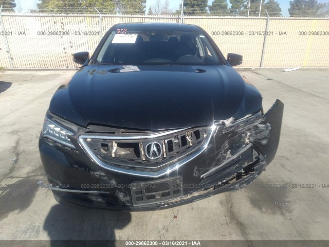 Photo 5 VIN: 19UUB1F59FA005125 - ACURA TLX 