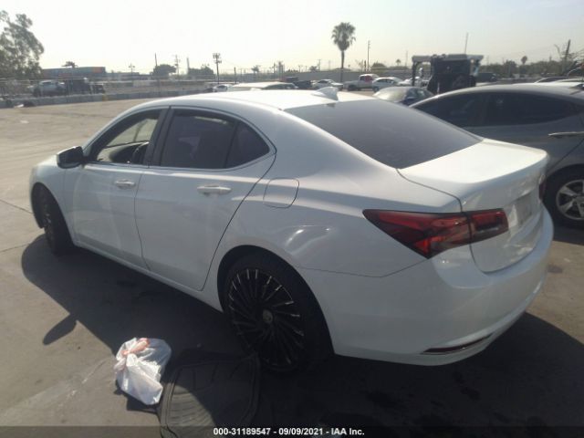 Photo 2 VIN: 19UUB1F59FA029327 - ACURA TLX 