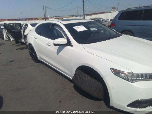 Photo 5 VIN: 19UUB1F59FA029327 - ACURA TLX 