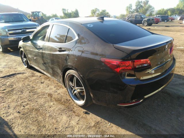 Photo 2 VIN: 19UUB1F59HA002003 - ACURA TLX 