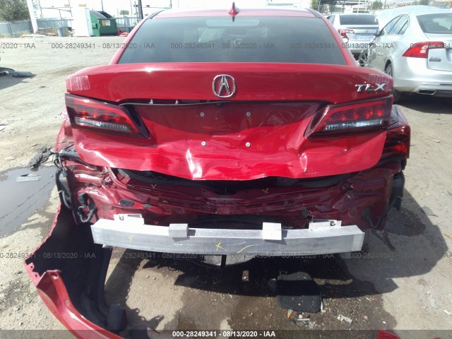 Photo 5 VIN: 19UUB1F59HA007976 - ACURA TLX 