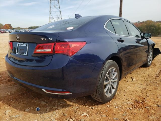 Photo 3 VIN: 19UUB1F59JA006350 - ACURA TLX 