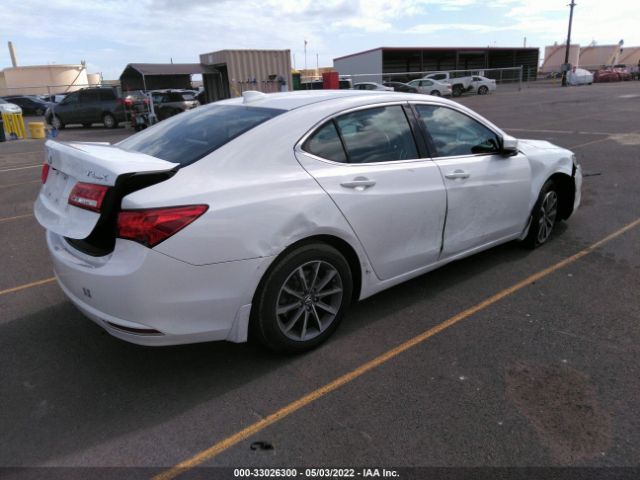 Photo 3 VIN: 19UUB1F59JA008602 - ACURA TLX 