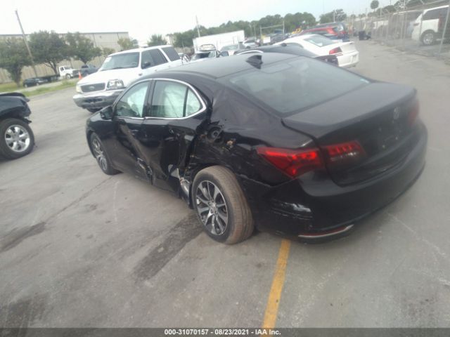 Photo 2 VIN: 19UUB1F5XHA004102 - ACURA TLX 