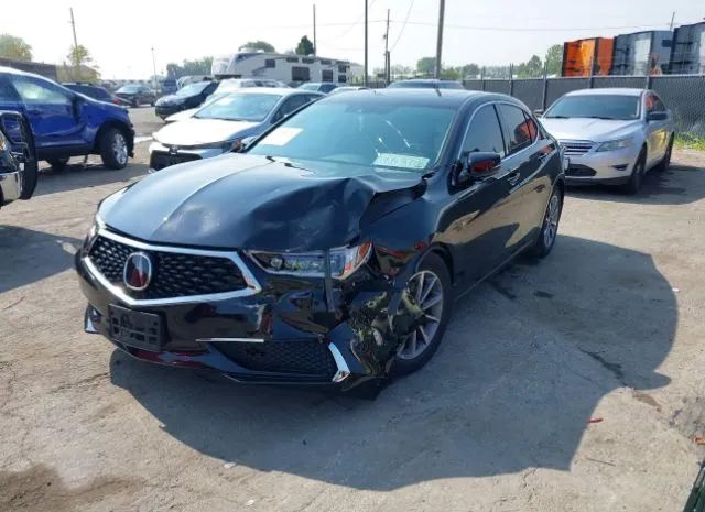 Photo 5 VIN: 19UUB1F5XKA004236 - ACURA TLX 