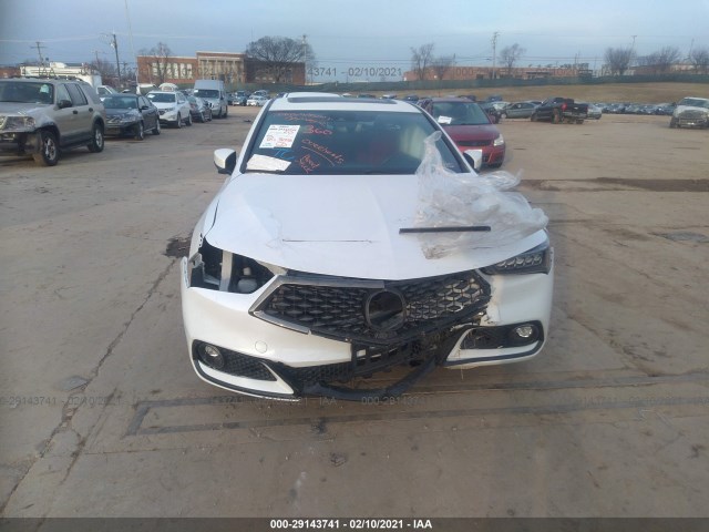 Photo 5 VIN: 19UUB1F62KA003185 - ACURA TLX 