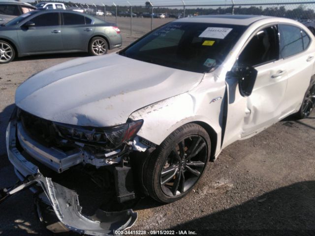 Photo 5 VIN: 19UUB1F62LA002944 - ACURA TLX 