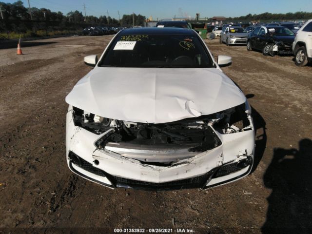 Photo 5 VIN: 19UUB1F66KA001908 - ACURA TLX 