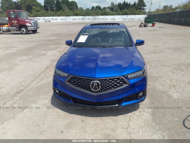 Photo 5 VIN: 19UUB1F6XLA011388 - ACURA TLX 