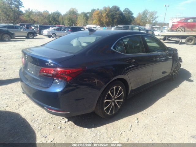 Photo 3 VIN: 19UUB2F30GA005147 - ACURA TLX 