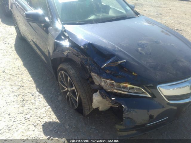 Photo 5 VIN: 19UUB2F30GA005147 - ACURA TLX 