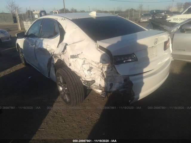 Photo 5 VIN: 19UUB2F30GA012678 - ACURA TLX 